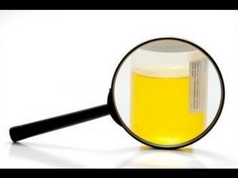 How to Pass a Urine Test for THC (Cannabis)