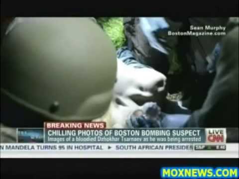 Proof FBI Lied? Boston Bombing Suspect... No Neck Wound.